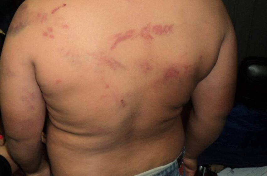 Mãe tortura filho no interior de Muitos Capões
