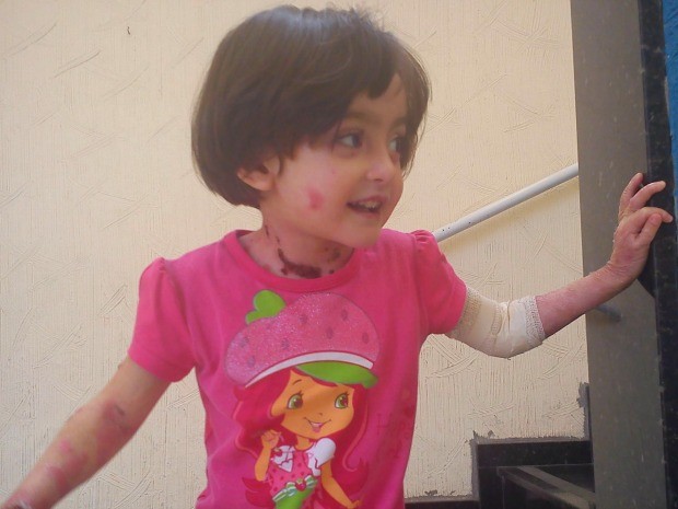 No RS, família busca R$ 3,5 milhões para tratar doença rara de menina