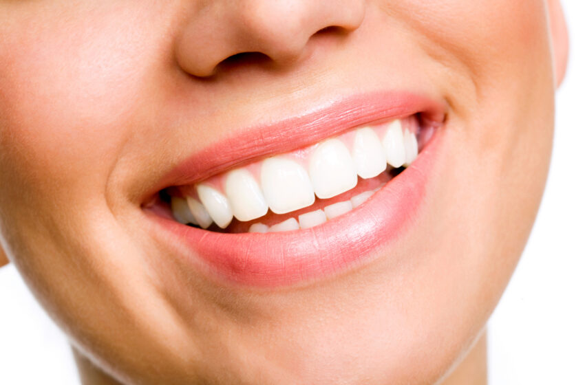  Mude dez hábitos para deixar os dentes mais brancos