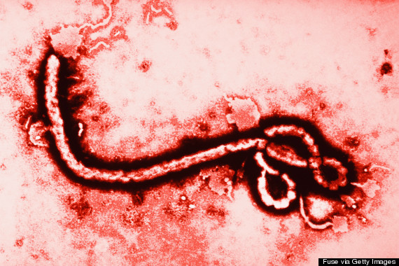  Resultado sobre suspeita de ebola no Brasil sai em 24 horas