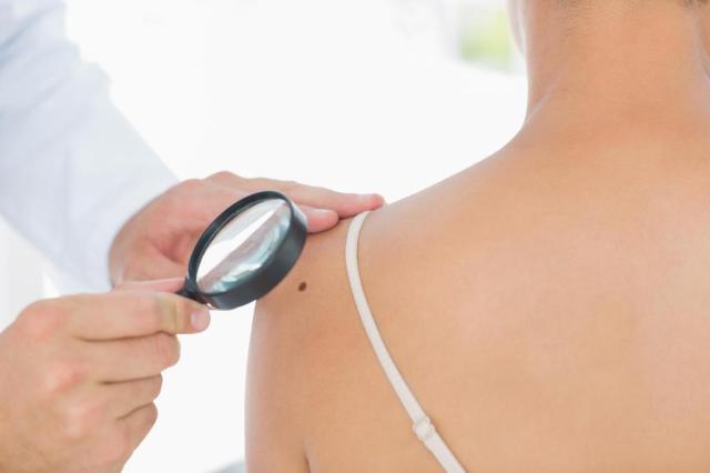  Novo medicamento pode ser promissor no tratamento do melanoma