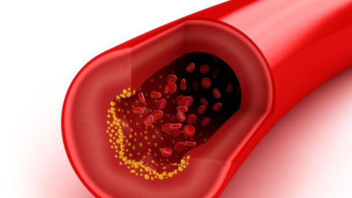 FDA aprova novo medicamento contra colesterol
