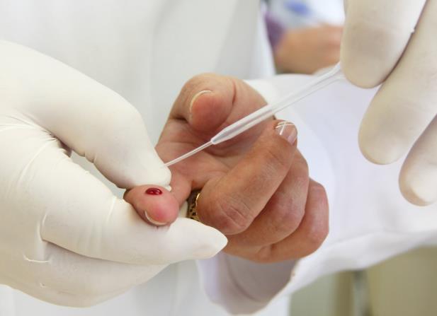 Anvisa aprova regras para venda de teste para aids em farmácias
