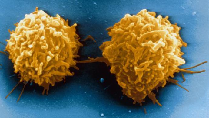 Novo tratamento para leucemia tem resultados surpreendentes