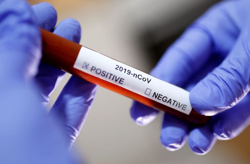 Testes de anticorpos para coronavírus são confiáveis?