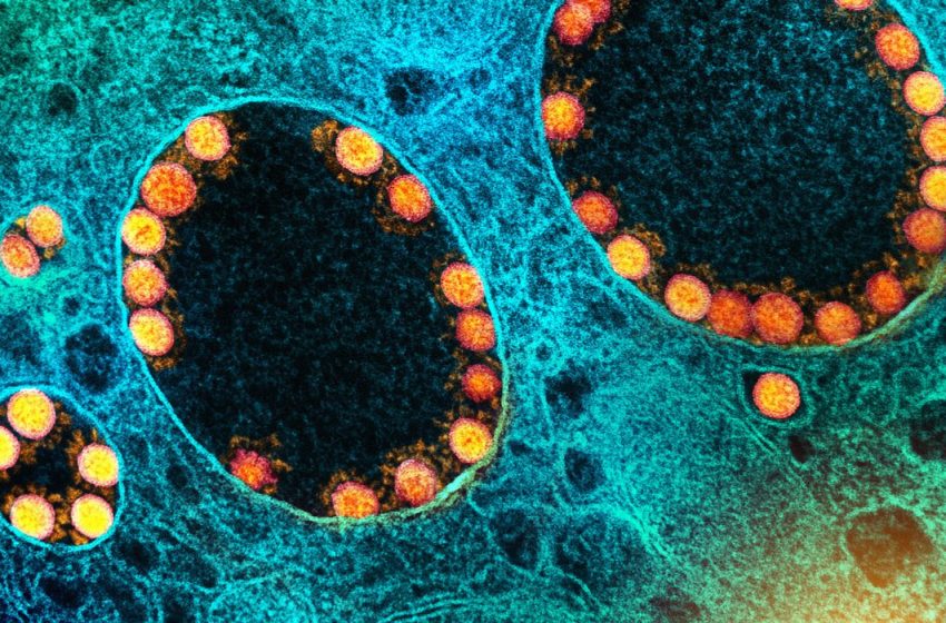  Pandemias futuras podem ser mais mortais e contagiosas, diz cientista